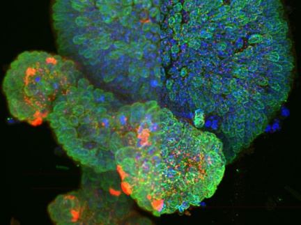 Dekonvoluce – PSF a algoritmy